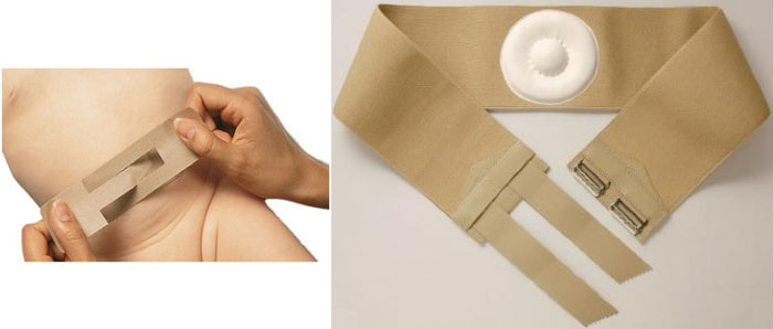 Современный пластырь и бандаж для лечения пупочной грыжи