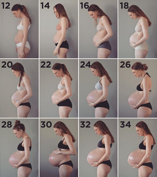 Беременность тройней от 12 до 34 недели