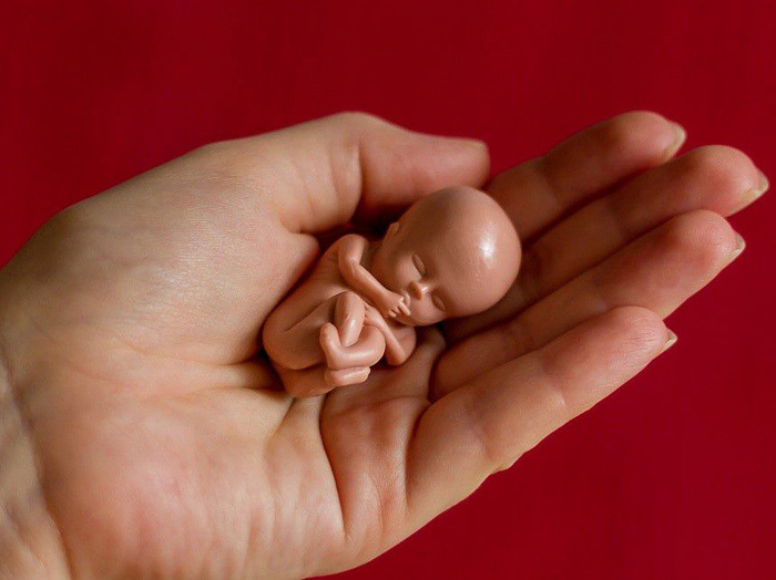 23 миллиона абортов сделаны только потому, что ребенок был не того пола