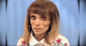"У меня давно нет весов”: девушка, которая весила 17 килограммов, рассказала о борьбе с анорексией