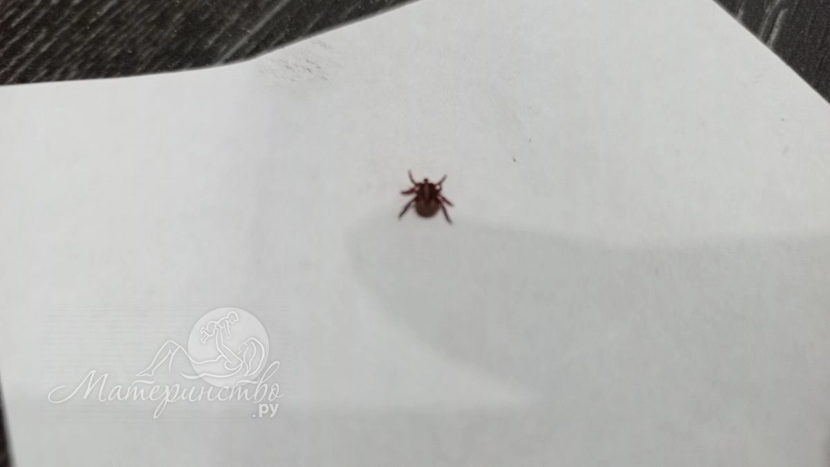 Педиатр рассказал о безопасном удалении клеща у ребенка 