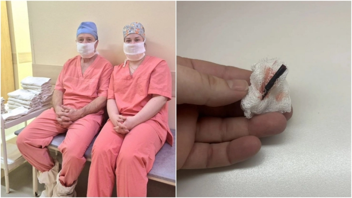 Саратовские хирурги с помощью УЗИ нашли и удалили деревянную щепу из руки ребёнка