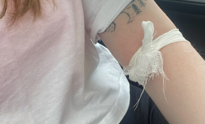 Пять главных признаков: как определить высокий сахар в крови без анализов